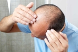 Why a Crown Hair Transplant is the Answer to Thinning Hair