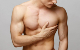 Managing Gynecomastia Naturally: Diet, Exercise, and Lifestyle Changes
