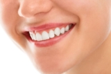 How Braces Can Address Misaligned Midlines