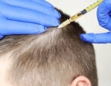 Invest in Your Hair: The PRP Injection Experience in Dubai