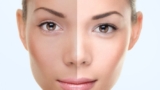 Permanent Skin Whitening What You Need to Know in Dubai