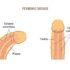 Sexual Treatment in India | Erectile Dysfunction & Depression / Anxiety