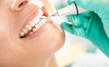 Reclaim Your Smile with Teeth Polishing and Scaling Services
