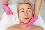 Rediscover Confidence with Thread Lift Treatment