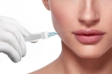 Reversing Lip Fillers: What You Need to Know