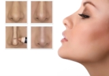 Rhinoplasty Surgery in Delhi
