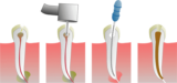 Best Tips to Prevent Gum Disease and Tooth Decay