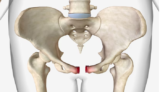The Ultimate Guide to Hip Replacement Cost in India
