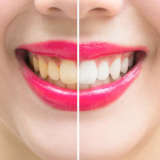 Emergency Dentist In Campbelltown – Must Know Tips To Find A Good One!