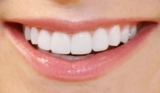 Teeth Whitening and Personal Development: Feeling Your Best