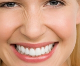 Teeth Whitening and Braces: What You Need to Know Before Whitening