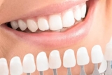 The Benefits of Choosing Dental Implants Over Other Tooth Replacement Options in Dubai