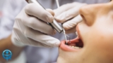 The Hidden Benefits of Orthodontic Treatments Beyond Aesthetics