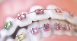 The Most Advanced Tools and Techniques Used by Orthodontists Today