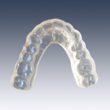 Night Guard Splints: A Non-Invasive Approach to Teeth Grinding Relief