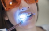 The Ultimate Guide to Zoom Teeth Whitening: What You Need to Know