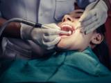 Top 10 Tips for a Smooth Recovery After Tooth Extraction