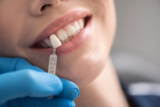 Top Cosmetic Dentists Predict Non-Prep Veneers Will Dominate 2025