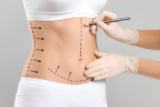 Exploring the Benefits of Tummy Tuck Procedures in Dubai