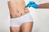 Comprehensive Guide to Tummy Tuck Procedures in Dubai