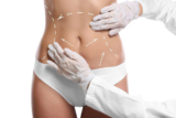 Exploring the Tummy Tuck Experience in Dubai