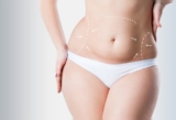 Dr. Amiti Shah – Tummy Tuck Surgery in Mumbai