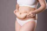 Tummy Tuck Surgery in Dubai: Mini Tummy Tuck Guide