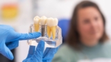 Dental Implants vs. Dentures: Which Is Better?