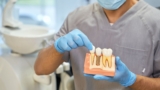 Is a Dental Implant in Geneva Right for You in 2025?