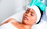 Microneedling Treatment: Your Ultimate Guide to Skin Rejuvenation