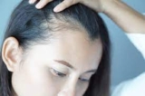 Why PRP for Hair Loss in Dubai is Gaining Popularity Among Locals and Tourists