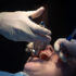 From Tension to Confidence: Surprising Benefits of Botox Cosmetics