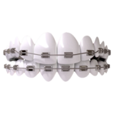 Vijaya Dental Care: Your Go-To for the Best Dental Care in Ayanavaram, Chennai