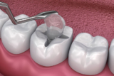 Best Dental Clinic in Villivakkam, Chennai – Trusted Dental Care for Healthy Smiles