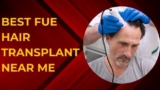 What Are the Benefits of a Best FUE Hair Transplant Near Me?