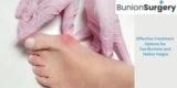 Effective Treatment Options for Toe Bunions and Hallux Valgus