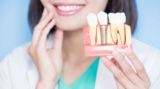 How to Talk to Your Dentist About Dental Implants: A Patient’s Guide