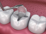 Dentist in Medavakkam | Vijaya Dental Care