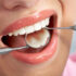 How Teeth Polishing Can Boost Your Confidence