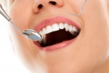 Wisdom Teeth and Oral Hygiene: Tips for a Healthy Mouth