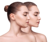 Effective Strategies for Double Chin Treatment in Dubai