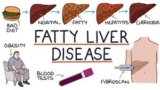 Overcoming Fatty Liver Disease: A Three-Step Journey to Health