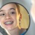 Dental Implants: A Comprehensive Guide