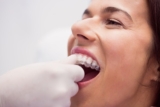 Clear Aligners: The Discreet Way to a Perfect Smile