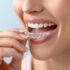 Dental Braces: Transforming Smiles with Orthodontic Precision