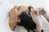 Bio FUE Transplant for Women: What You Should Know