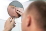 How Long Does a Hair Transplant Last?