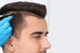 Hair Transplant Experts in Dubai: Let Us Redefine Your Look!