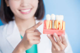Dental Implants: A Permanent Solution for Missing Teeth