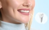 The Connection Between Dental Implants and Oral Health